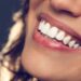 Gummy Smile Behandlung Botox Hannover