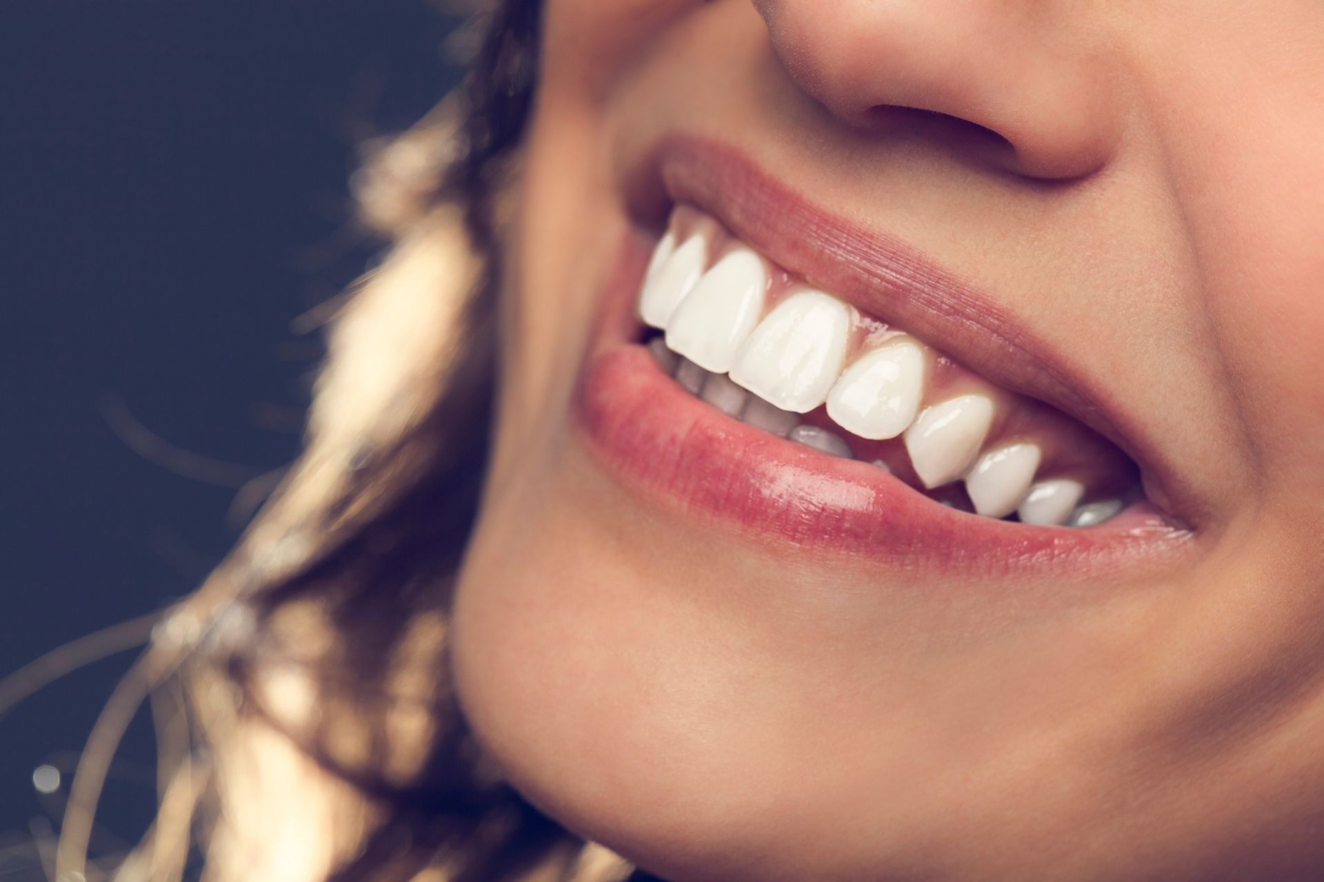 Gummy Smile Behandlung mit Botox