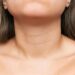 Halsstraffung mit Botox – Straffer Hals ohne Operation in Hannover
